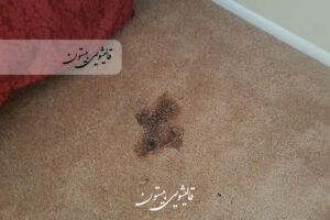 تصویر از بین بردن سوختگی فرش